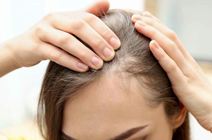 Dies Sind Die 5 Besten Haarfasern Für Dünner Werdendes Haar